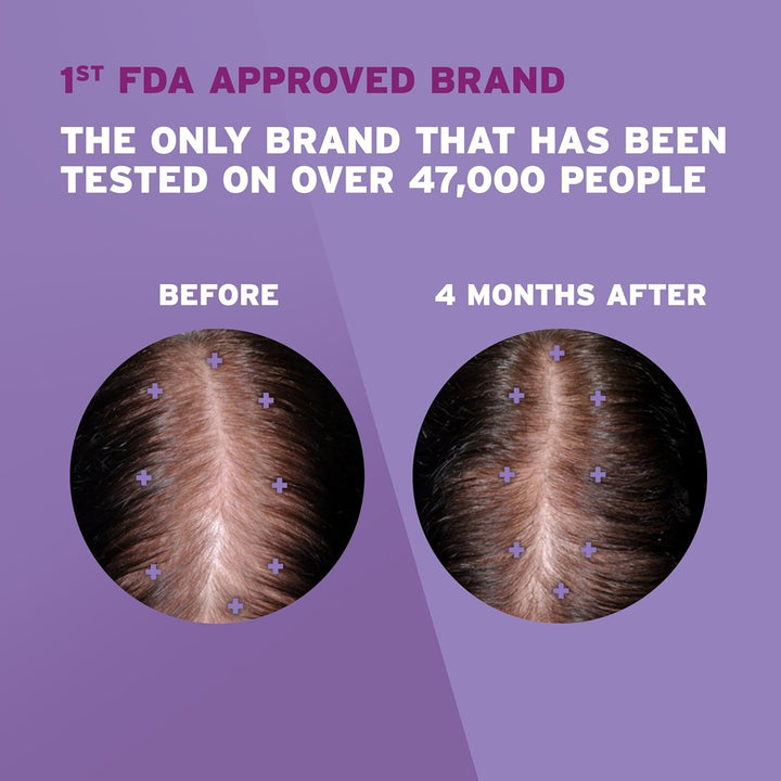 Women's Rogaine 2% Minoxidil Topical Solution for Thin Hair