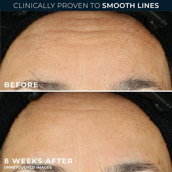 RoC Retinol Correxion Line Smoothing Night Serum Capsules - 30 Capsules