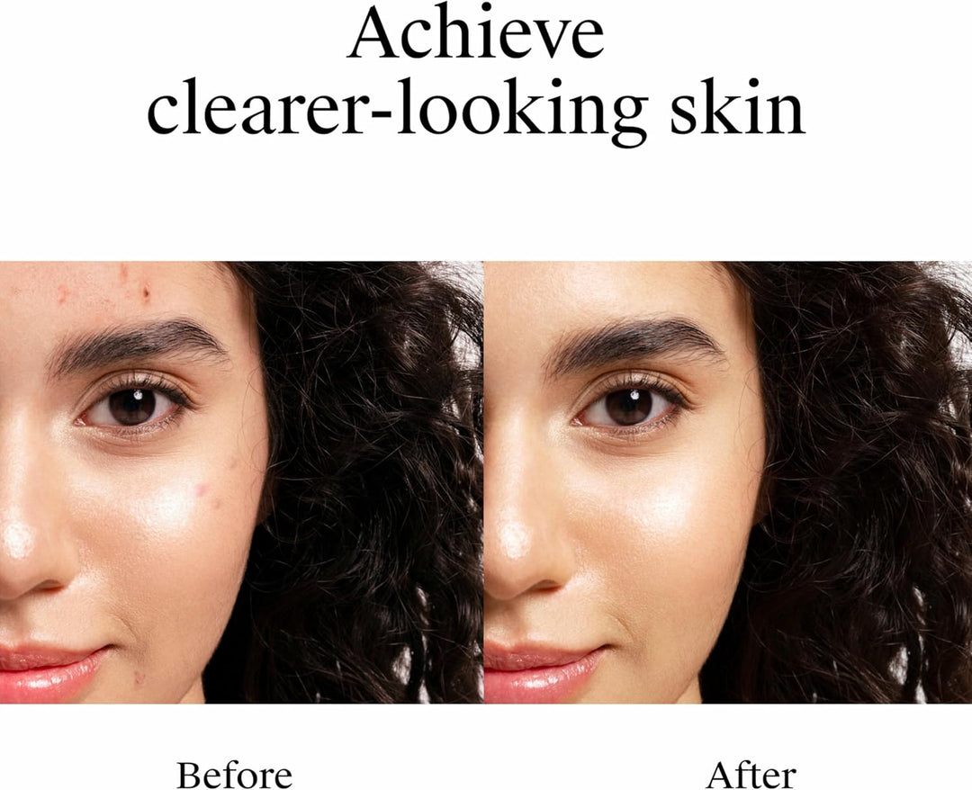 Neutrogena Rapid Clear Stubborn Acne Spot Treatment Gel - 28g