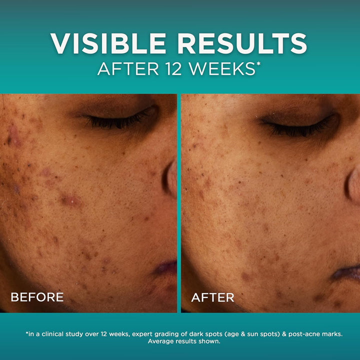 Loreal Paris Bright Reveal 12% [Niacinamide + Amino Sulfonic + Ferulic] Dark Spot Serum