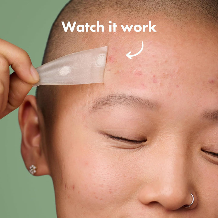 Mighty Patch Surface Large Pimple Patches for Face - 10 Hydrocolloid patches
