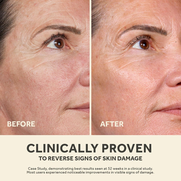 No7 Future Renew Damage Reversal Anti Aging Serum