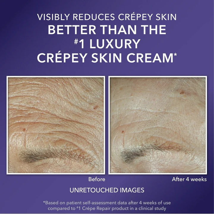 Roc MULTI CORREXION Crepe Repair Face & Neck Cream - 48g