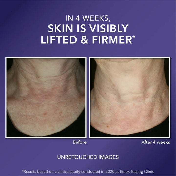 Roc MULTI CORREXION Crepe Repair Face & Neck Cream - 48g