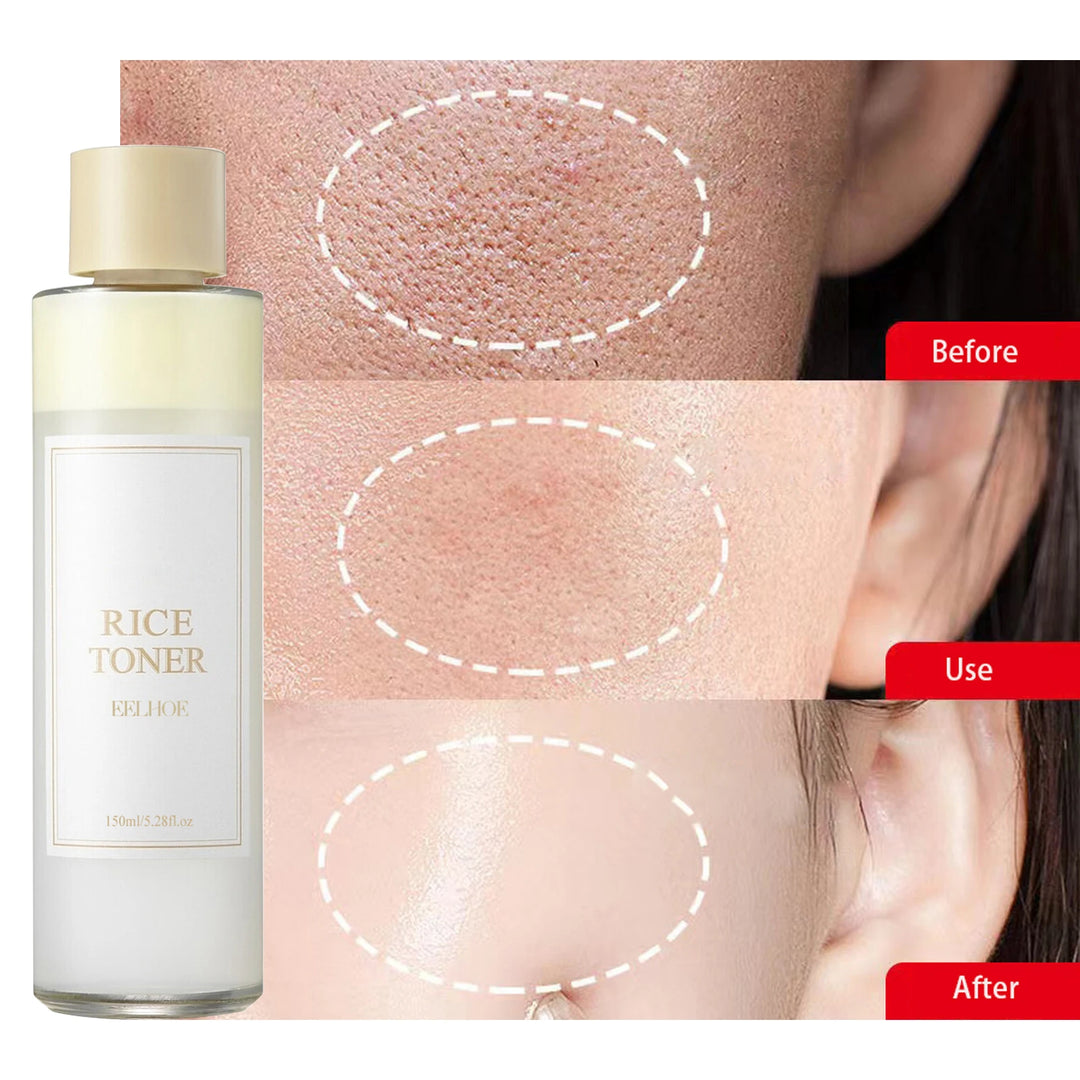 I'm from Rice Toner 150 Ml- Exp 1-27