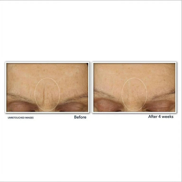 Roc Retinol Correxion Line Smoothing Max Hydration+ Moisturizer