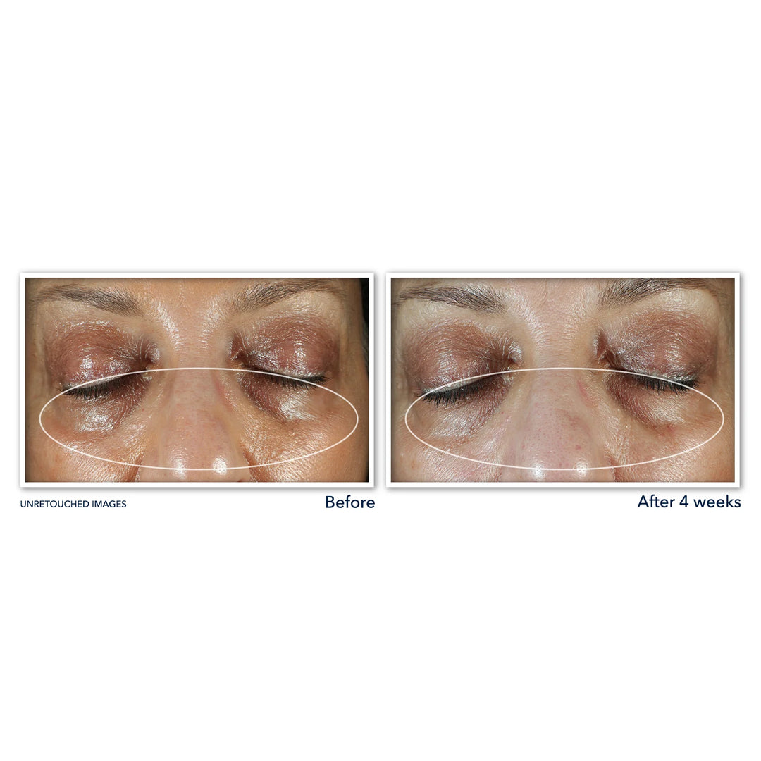 Roc Multi Correxion Even Tone + Lift Eye Cream - 15ml