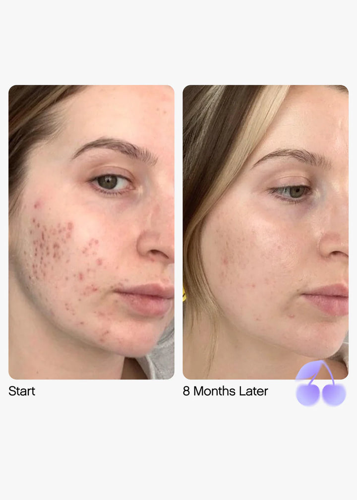 Topicals Faded Serum for Dark Spots & Discoloration