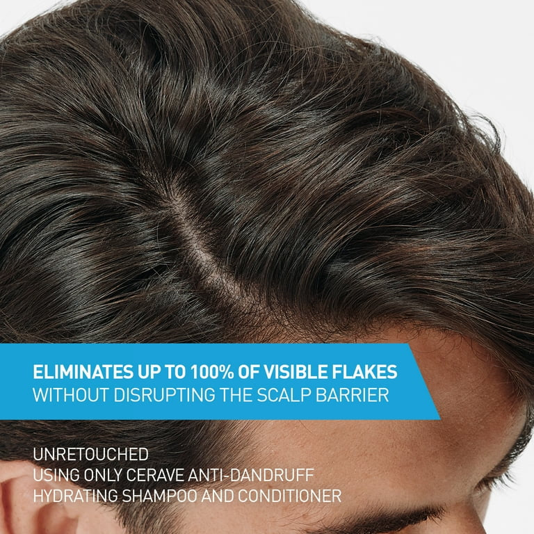 CeraVe Hydrating Anti Dandruff Shampoo Sulfate Free & Color Safe Itchy Scalp Treatment 355 Ml