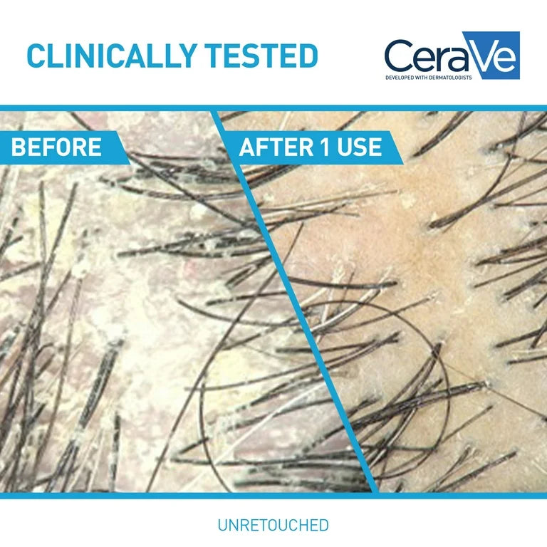 CeraVe Hydrating Anti Dandruff Shampoo Sulfate Free & Color Safe Itchy Scalp Treatment 355 Ml