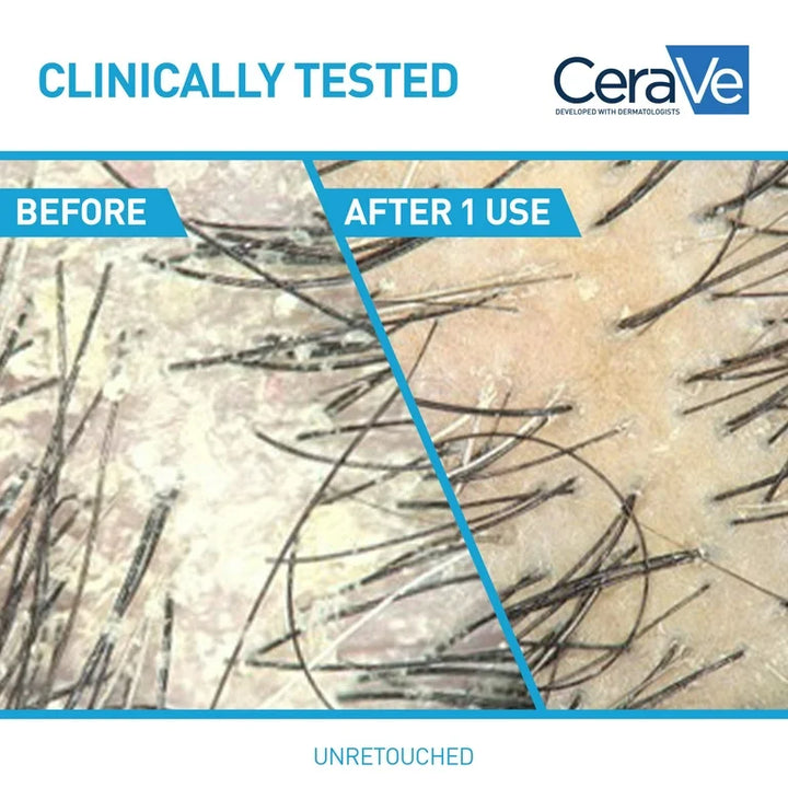 CeraVe Hydrating Anti Dandruff Shampoo Sulfate Free & Color Safe Itchy Scalp Treatment 355 Ml