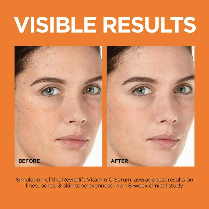 Loreal Revitalift Vitamin C Vitamin E Salicylic Acid Serum