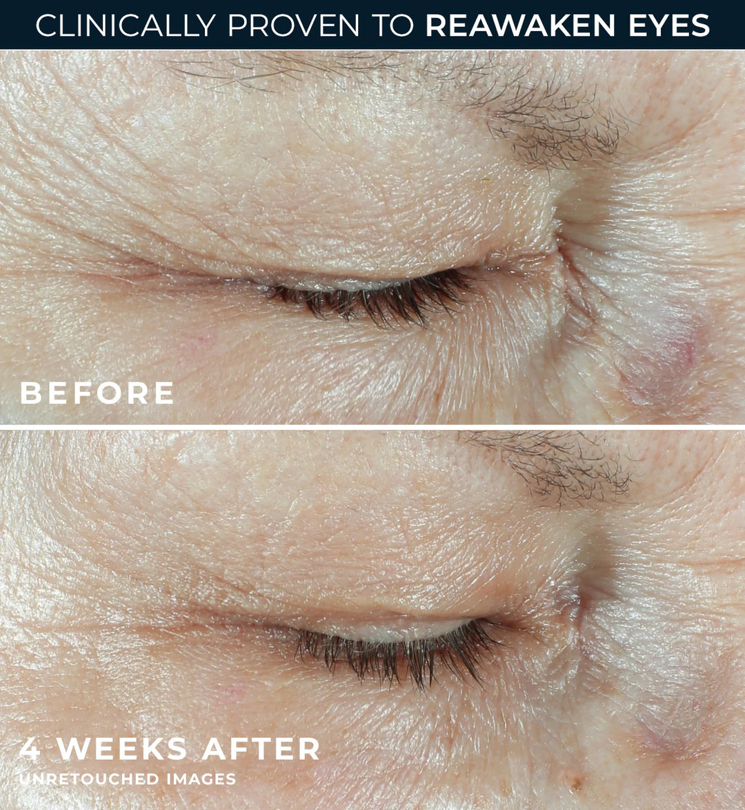 MULTI CORREXION Hydrate + Plump Eye Cream - 15ml