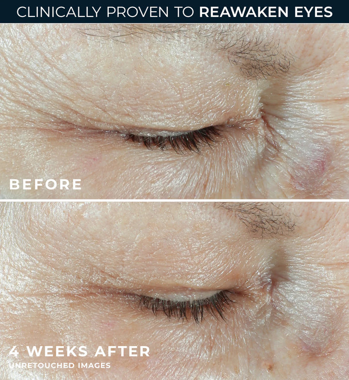 MULTI CORREXION Hydrate + Plump Eye Cream - 15ml